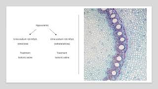 Hyponatremia [upl. by Glori]