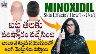 Right way to use MINOXIDIL SOLUTION for HAIR LOSSEXPERT ADVICEDrDeepak P Devakar Doctors Circle [upl. by Nolrak157]