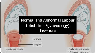 Abnormal labour Cephalopelvic disproportion part 1 causessignscomplications  obstetrics lecture9 [upl. by Mcbride]