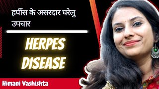 हर्पीस के असरदार घरेलु उपचार ।। Home remedies for herpes disease in Hindi 2022 [upl. by Tanya516]