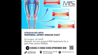 Peripheral Artery Disease No Surgery All Relief [upl. by Suivatnad130]