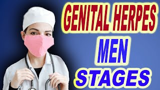 genital herpes men stages [upl. by Scarito]