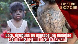 Bata tinubuan ng makapal na balahibo at buhok ang mukha at katawan  Kapuso Mo Jessica Soho [upl. by Nyleimaj]