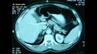 Cross sectional and imaging anatomy of the abdomen [upl. by Richardson99]