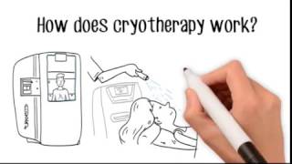 What is Cryotherapy  Cryotherapy Whiteboard Video [upl. by Tiras]