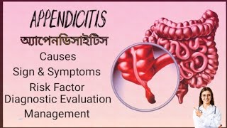 Appendicits  অ্যাপেনডিসাইটিস  Causes Risk factor  Sign amp Symptoms  Treatment  Management [upl. by Ferrick]