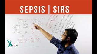 Sepsis  SIRS Multi organ failure  বাংলা [upl. by Oinotnaesoj]