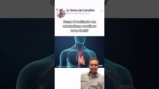 Como é realizado um cateterismo cardíaco com stent [upl. by Schroth]