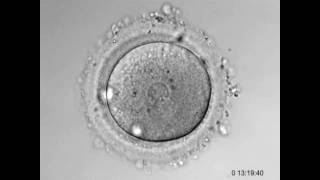 Fertilization Conception Explained From Fertilization To Childbirth  3D Animation [upl. by Manheim430]