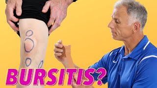 What Is Causing Your Knee Pain Bursitis How To Tell [upl. by Obie]