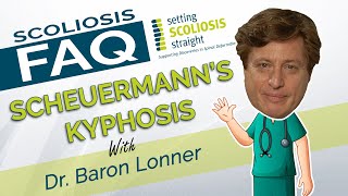 Scoliosis FAQ  Scheuermanns Kyphosis [upl. by Nona]