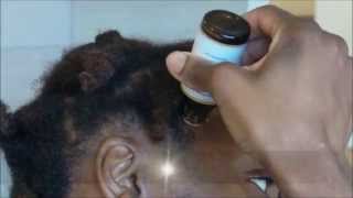 Comment favoriser la repousse des cheveux sur les tempes [upl. by Ybrek]