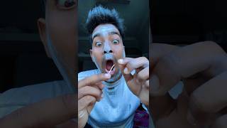 Sick hangnail 😲🤣 full version [upl. by Assyram]