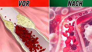 5 LEBENSMITTEL DIE SIE ESSEN MÜSSEN WENN SIE ARTERIEN REINIGEN WOLLEN  NAHRUNG FÜR ARTERIEN [upl. by Lounge486]