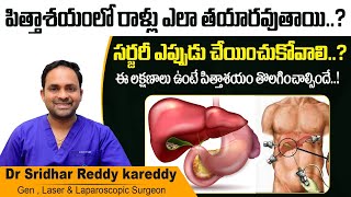 పిత్తాశయంలో రాళ్లు  Gallbladder Stones Symptoms and Treatment in Telugu  Treatment Range Hospitals [upl. by Carbrey465]