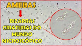 Amebas Conheça essas bizarras criaturas do mundo microscópico [upl. by Bonaparte]