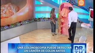 Cáncer de colon  Síntomas y tratamiento [upl. by Lellih]