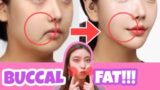 Buccal Fat Removal Exercise amp Massage  Reduce Cheek Fat Chubby Cheeks No Surgery💕 [upl. by Dihsar]