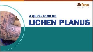 A patients guide to understanding Lichen Planus [upl. by Yoj]