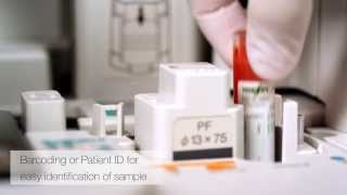 FUJIFILM NX 500  Laboratory diagnosis in minutes  more time for your patients [upl. by Ainola]