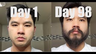 I Grew Out My Beard For 3 Months Using Minoxidil Rogaine [upl. by Klute300]