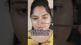 Day 40 DIY easy way to remove Blackheads amp Whiteheads 100days 100beautytips shorts skincare [upl. by Scarface]