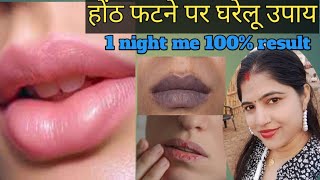 सर्दीयो में होंठ फटने पर घरेलू उपायget baby pink lips in just one night [upl. by Nesyrb]