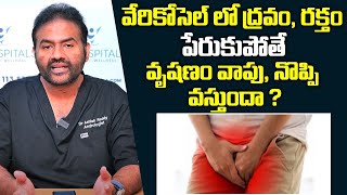 వృషణం వాపు నొప్పి వస్తుందా అయితే ఇలా చేయండి  Causes For Varicocele and Hydrocele Pain  Andro9 [upl. by Aneel]