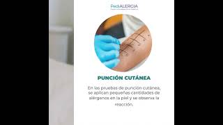 Tipos de pruebas de alergia en la piel alergias asma dermatitisatópica rinitisalergica ronchas [upl. by Uohk]