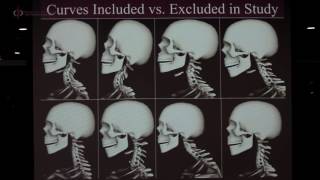 CBP NP 35 Cervical Lordosis Neck Pain [upl. by Payne]