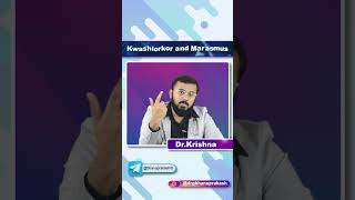 Kwashiorkor Vs Marasmus  Quick Bites [upl. by Eserahs]