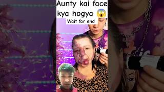 Aunty ka face par acid 😱 endshortsyoutubeshortsviraltrendingytshorts [upl. by Anstus]