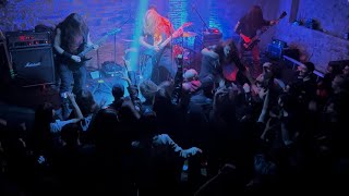 Hyperdontia Full Set  Live  Blind  Istanbul  05112022 [upl. by Angle422]