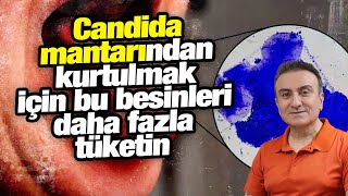 Candida mantarı ile savaşan besinler Candida diyeti [upl. by Chobot]