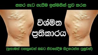 නහර ගැට ගැසීම ඉක්මනින් සුවකරන විශ්මිත අත් බෙහෙත  Best Home Remedy For Varicose Veins [upl. by Alexandria636]