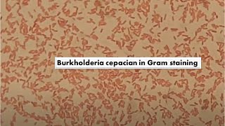 Burkholderia cepacia in Gram Staining of Culture Mag4000X [upl. by Parthenia]