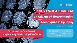 4th Lecture Surfacebased morphometry in MRI using FreeSurfer [upl. by Neela]