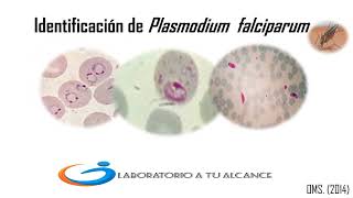 Identifica Plasmodium falciparum En 3 minutos [upl. by Caddaric]