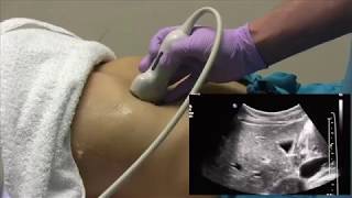 How I do it Ultrasound of the Abdomen [upl. by Ofella]