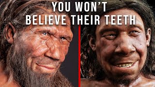 Cavemen had BETTER Teeth than You Here’s Why [upl. by Asaert]