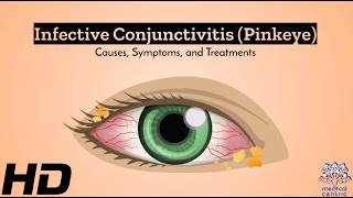 Infective Conjunctivitis Behind the Redness [upl. by Paula]