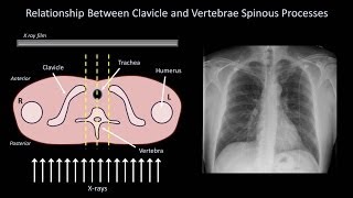 How to Interpret a Chest XRay Lesson 3  Assessing Technical Quality [upl. by Kehr387]