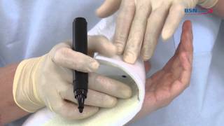 Synthetic splinting thumb amp wrist immobilizerENby BSN medicalmov [upl. by Staley110]