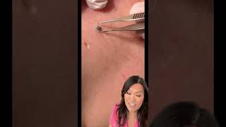 Some great blackheads and DPOWs on the back [upl. by Nivag]