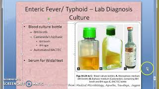 Microbiology 321 e Salmonella Typhoid Culture Stool Selenite TTB DCA XLD Wilson blair Lab Diagnosis [upl. by Caddric]