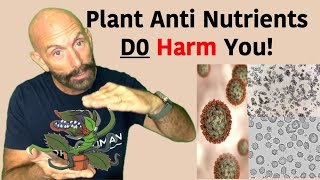 Are Plant AntiNutrients Harming You antinutrients oxalate [upl. by Ardnuek299]