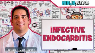 Infective Endocarditis [upl. by Linskey]