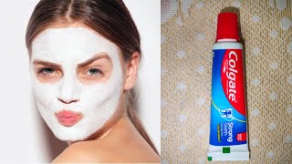 5 Brilliant Toothpaste hacks 5 Aweasome toothpaste Life tricks by AESTHETIC ANJALI [upl. by Persian]