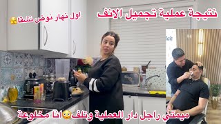 درتها لراسي🫨راجل دار عملية تجميل وتسيف وتزادت فيه ظلعة😰نتيجة الانفاول نهار نطيب بعد سفردردشة معا [upl. by Malinde74]