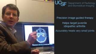 How to treat juvenile idiopathic arthritis UCSF [upl. by Hendrickson744]